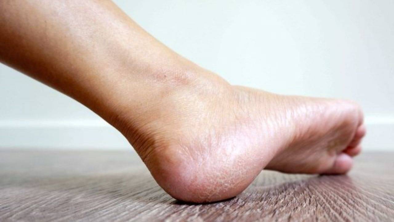 Protein Deficiency: আপনার শরীরে প্রোটিনের ঘাটতি আছে কি না, তা বুঝবেন কী করে? সবিস্তারে জেনে নিন...