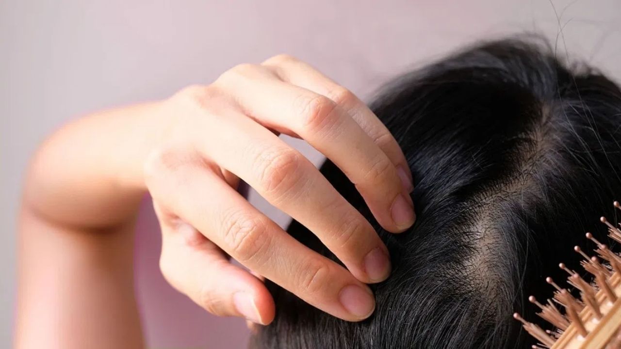 Hair Fall Remedies: চুলের যাবতীয় সমস্যা থেকে মুক্তি পেতে এই ৫ টি খাবার খেলেই হবে...