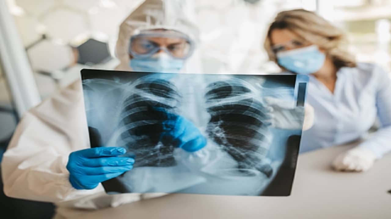 AI-based Covid Test: এক্স-রে ব্যবহার করে ২ ঘণ্টায় কোভিড টেস্ট, ৯৮% নির্ভুলতা, পিসিআর টেস্টের জায়গা নিতে পারে এআই-ভিত্তিক প্রযুক্তি