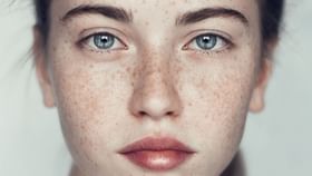 Freckles: কোনও ভাবেই নিয়ন্ত্রণ করতে পারছেন না ফ্রিকেলসের সমস্যাকে? বেছে নিন ঘরোয়া প্রতিকার Freckles: কোনও ভাবেই নিয়ন্ত্রণ করতে পারছেন না ফ্রিকেলসের সমস্যাকে? বেছে নিন ঘরোয়া প্রতিকার