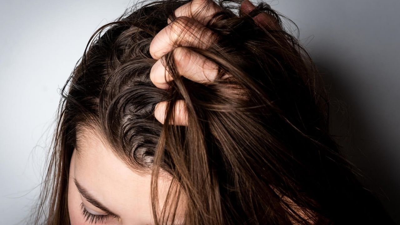 Greasy Hair: Even after shampooing, the oily hair does not cut? Choose a  home remedy for hair this winter Home remedies to get rid of greasy hair in  this winter | PiPa