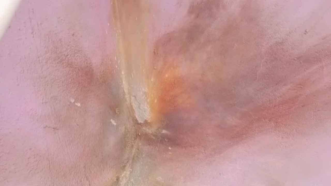 Murshidabad Bombing: মুর্শিদাবাদে তৃণমূল নেতার বাড়িতে মধ্যরাতে বোমাবাজি, কাঠগড়ায় দলীয় নেতাই