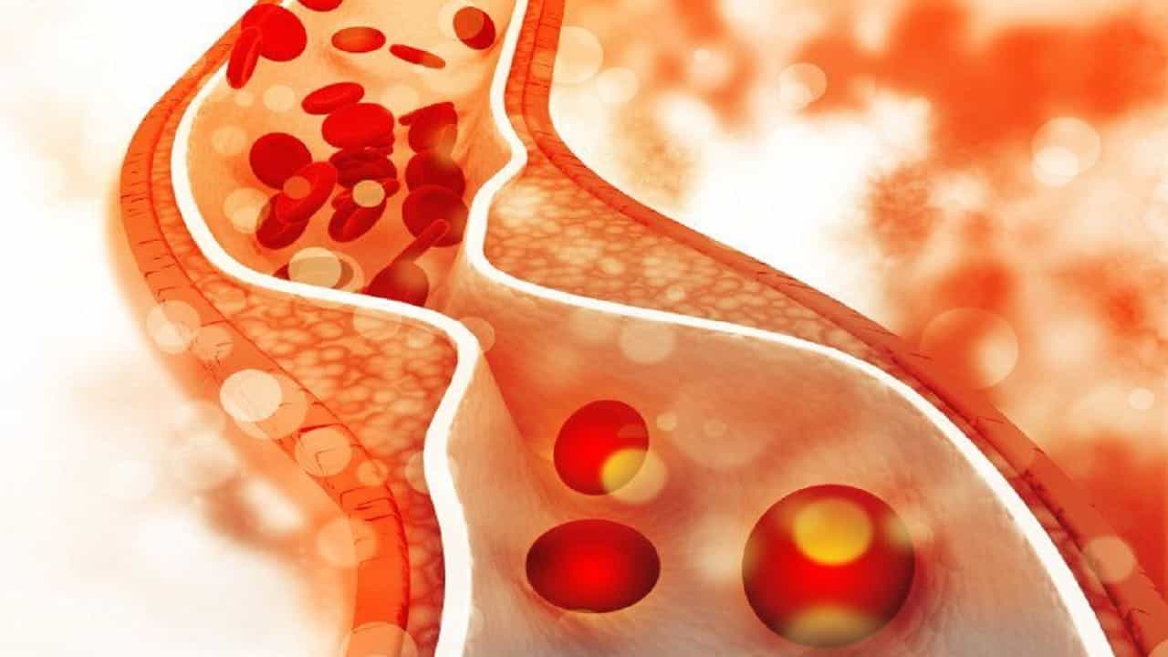 High cholesterol: শরীরের এই সব জায়গায় ব্যথা? কোলেস্টেরল বাড়ার ইঙ্গিত কিন্তু! তাই অবহেলা নয়... High cholesterol: শরীরের এই সব জায়গায় ব্যথা? কোলেস্টেরল বাড়ার ইঙ্গিত কিন্তু! তাই অবহেলা নয়...