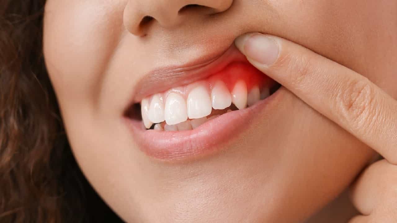 Healthy teeth: মাড়ি থেকে কি প্রায়ই রক্ত পড়ে? অবহেলা নয়, কাজে লাগান এই অব্যর্থ ঘরোয়া টোটকা... Healthy teeth: মাড়ি থেকে কি প্রায়ই রক্ত পড়ে? অবহেলা নয়, কাজে লাগান এই অব্যর্থ ঘরোয়া টোটকা...