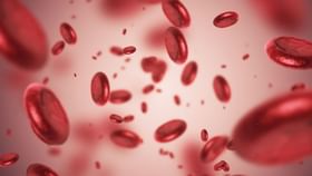 Anemia Prevention: আমাদের শরীরের রক্তাল্পতা দূর করার জন্য কয়েকটি খাবার নিয়মিত খেতে হবে... Anemia Prevention: আমাদের শরীরের রক্তাল্পতা দূর করার জন্য কয়েকটি খাবার নিয়মিত খেতে হবে...