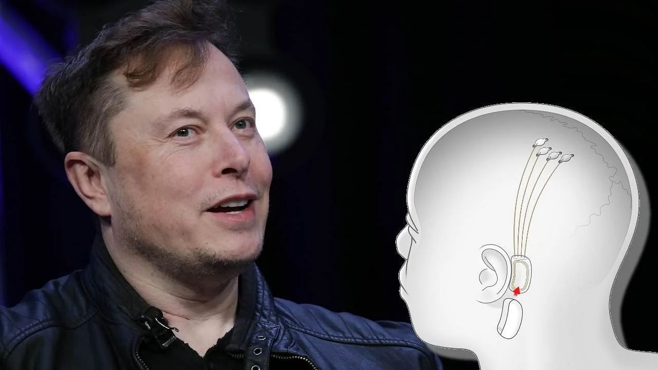 Elon Musk's Neuralink Brain Chip: মানুষের মস্তিষ্কের সঙ্গে ডিভাইস কানেক্ট করবে এলন মাস্কের নিউরালিঙ্ক, যোগাযোগ হবে ভাবনার মাধ্যমে!
