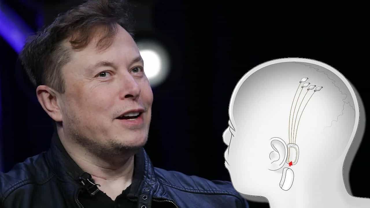 Elon Musk's Neuralink Brain Chip: মানুষের মস্তিষ্কের সঙ্গে ডিভাইস কানেক্ট করবে এলন মাস্কের নিউরালিঙ্ক, যোগাযোগ হবে ভাবনার মাধ্যমে! Elon Musk's Neuralink Brain Chip: মানুষের মস্তিষ্কের সঙ্গে ডিভাইস কানেক্ট করবে এলন মাস্কের নিউরালিঙ্ক, যোগাযোগ হবে ভাবনার মাধ্যমে!