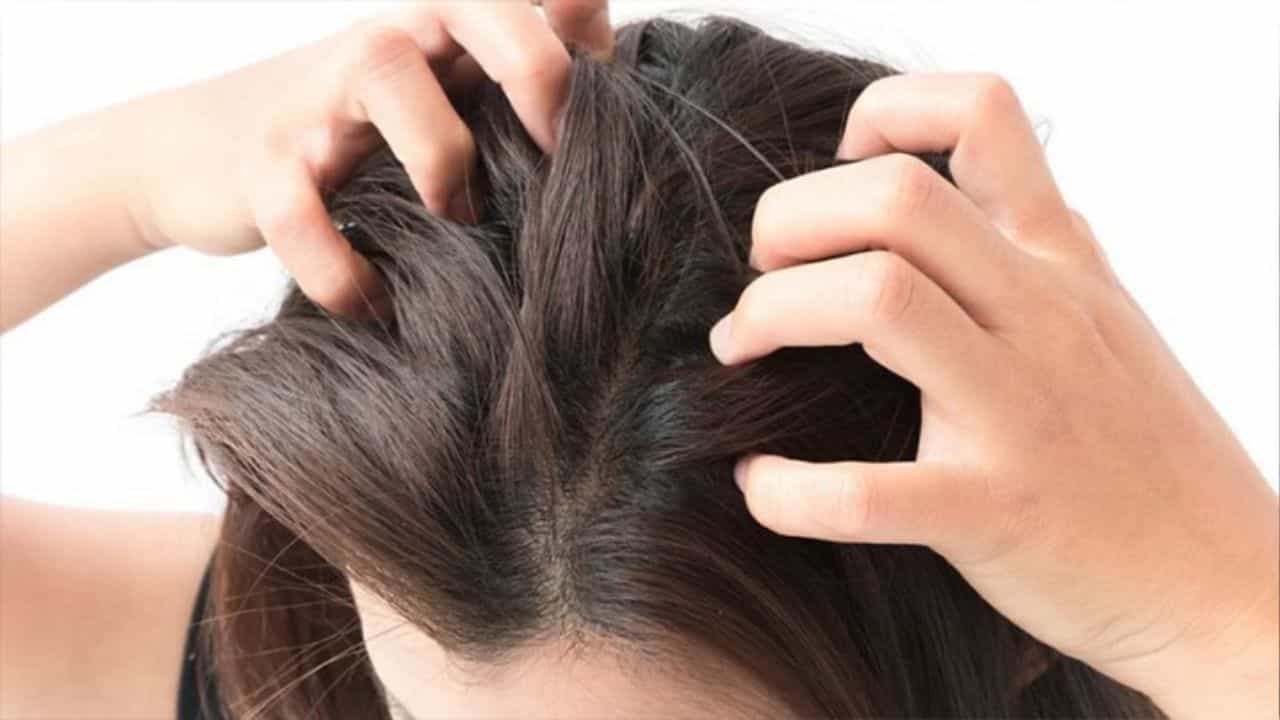 Scalp Pimples: মুখে তো বটেই, মাথার ত্বকেরও রয়েছে ব্রণের সমস্যা! মুক্তি পেতে এই ৬টি ঘরোয়া উপায়েই মিলবে সমাধান Scalp Pimples: মুখে তো বটেই, মাথার ত্বকেরও রয়েছে ব্রণের সমস্যা! মুক্তি পেতে এই ৬টি ঘরোয়া উপায়েই মিলবে সমাধান
