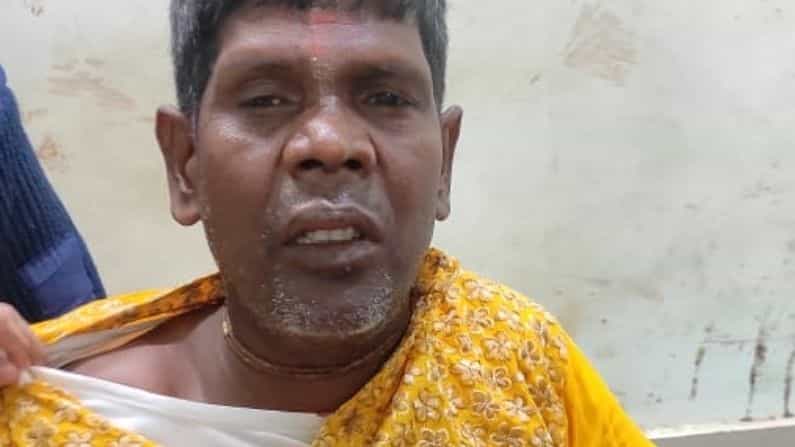 Bhuban Badyakar Hospitalized: গাড়ি চালাতে গিয়ে দুর্ঘটনার কবলে 'বাদাম কাকু', ভর্তি হাসপাতালে Bhuban Badyakar Hospitalized: গাড়ি চালাতে গিয়ে দুর্ঘটনার কবলে 'বাদাম কাকু', ভর্তি হাসপাতালে
