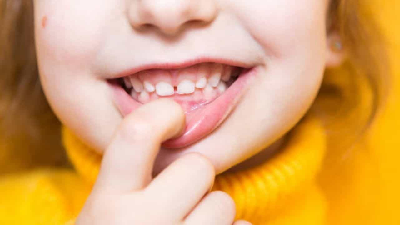 Child's Health: আপনার শিশুর ওরাল হেলথের যত্ন নিতে হবে আপনাকেই! এর জন্য কী উপায় মেনে চলবেন?