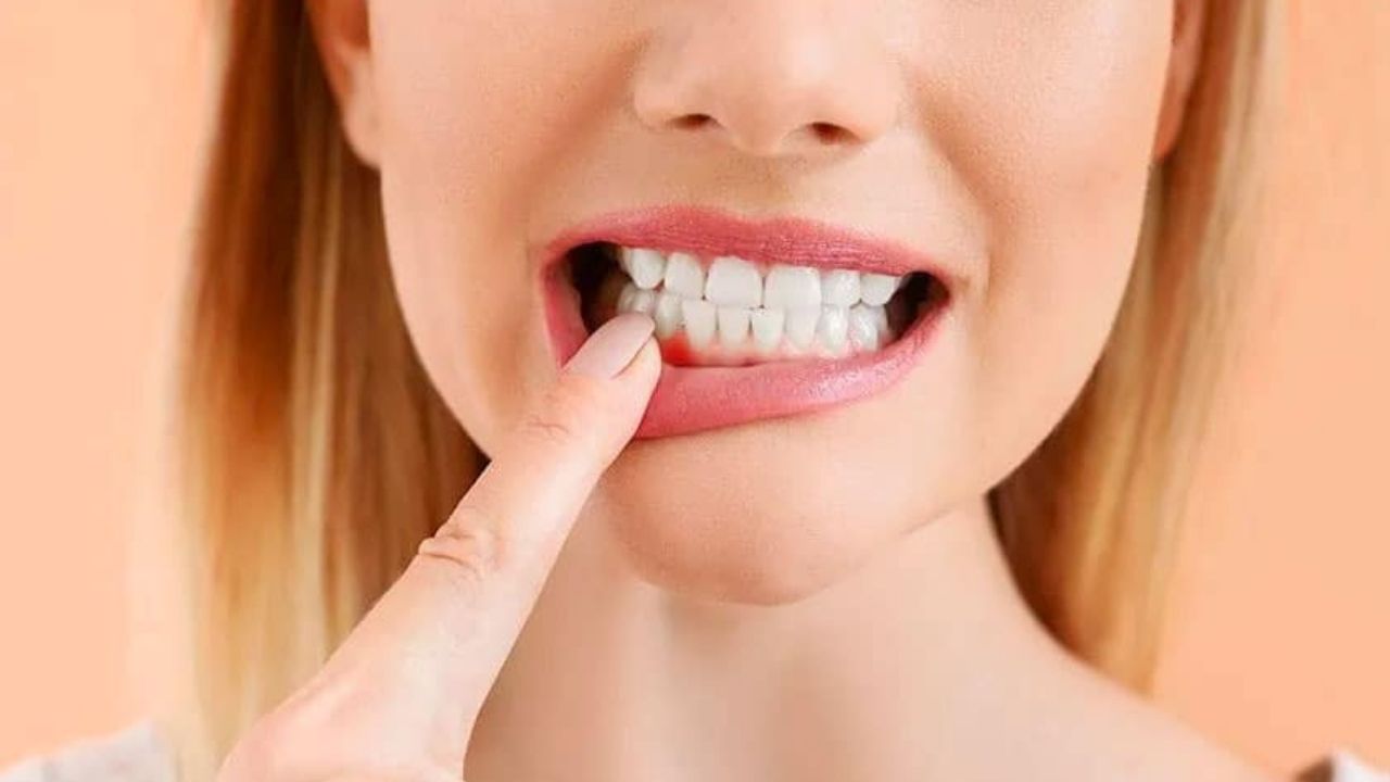 Gum Problems: দাঁত ও মাড়ির ব্যথায় অস্থির! দ্রুত আরাম পেতে এই ৫ ঘরোয়া টিপসেই রাখুন ভরসা