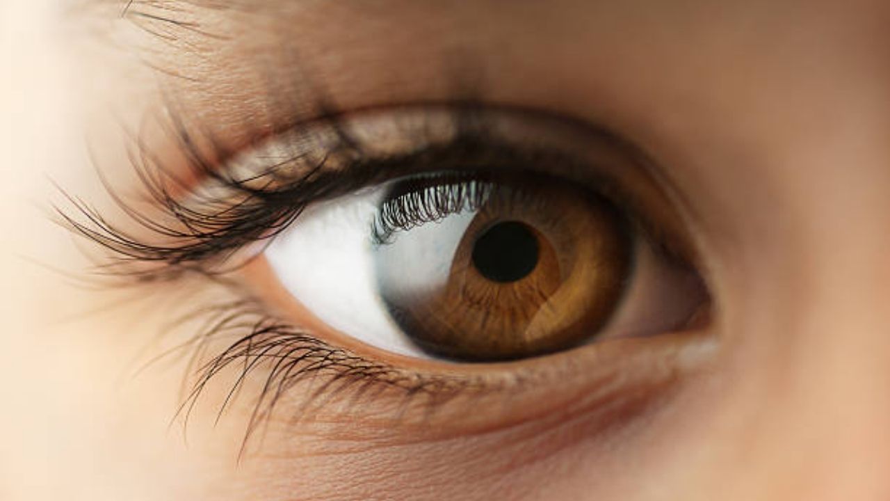 Hypercholesterolemia: Your eyes will tell if you are suffering from cholesterol problem