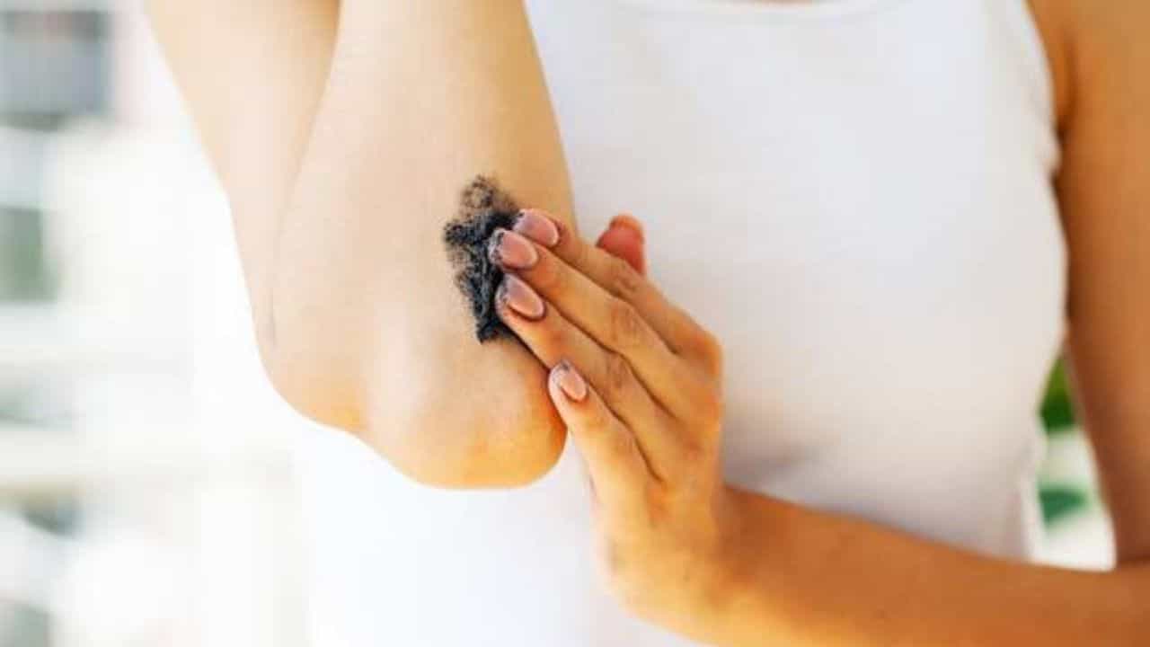 Skin Care Tips: হাঁটু ও কনুইয়ে কালো ছোপ? ঘরোয়া এই 8 উপায়েই মিলতে পারে সমাধান Skin Care Tips: হাঁটু ও কনুইয়ে কালো ছোপ? ঘরোয়া এই 8 উপায়েই মিলতে পারে সমাধান