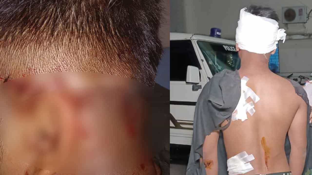 Baruipur Crime: মাথা-কানের পিছন-পিঠ, ব্লেড দিয়ে ফালা ফালা করে কাটা! উচ্চ মাধ্যমিক পরীক্ষার্থীর কথায় শিউরে উঠলেন চিকিৎসকরাই