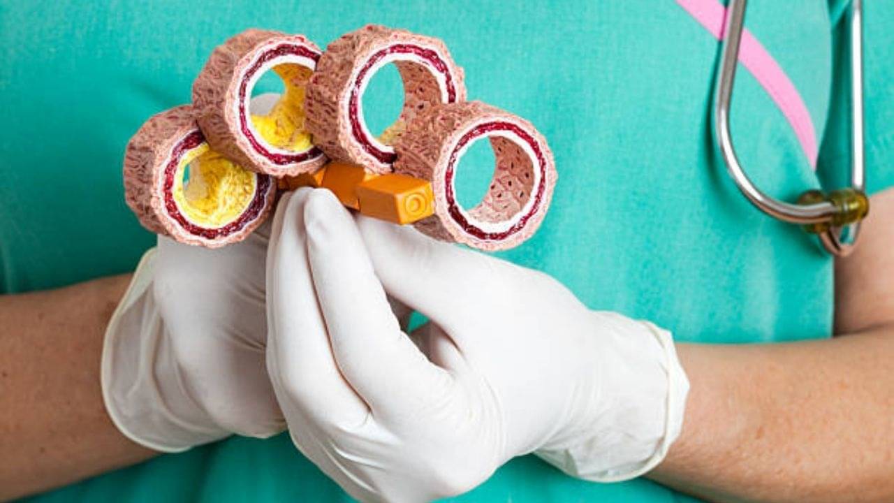 Good Cholesterol: এইচডিএল বা ভাল কোলেস্টেরলের মাত্রা বাড়াবেন কীভাবে? টিপস শেয়ার করলেন পুষ্টিবিদ