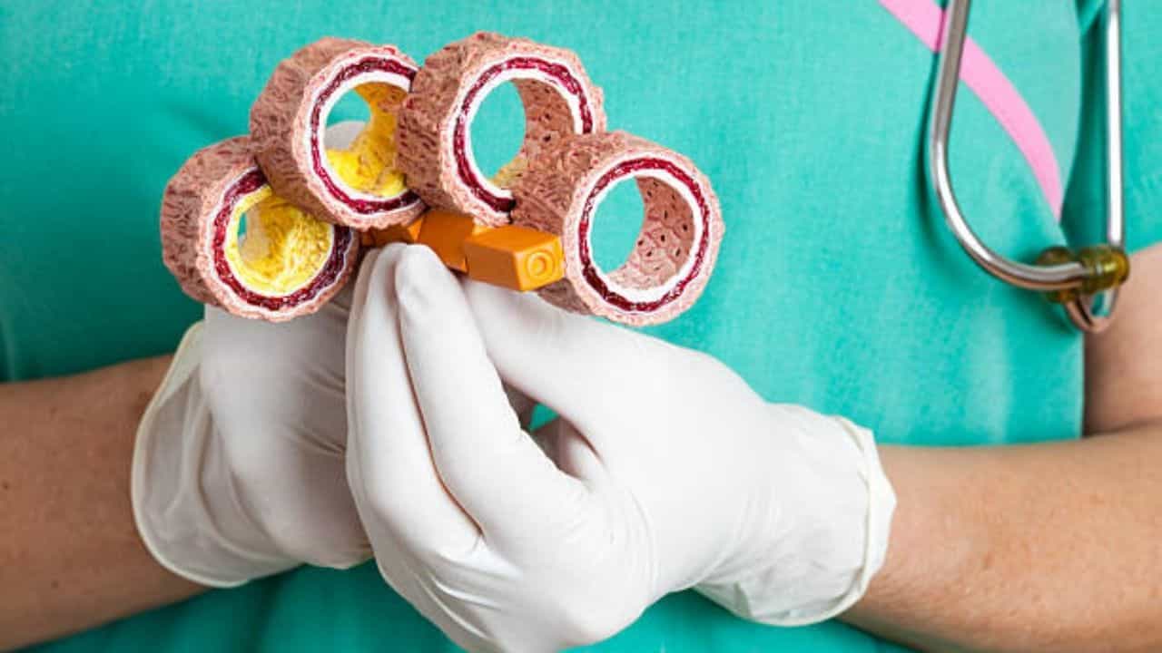 Good Cholesterol: এইচডিএল বা ভাল কোলেস্টেরলের মাত্রা বাড়াবেন কীভাবে? টিপস শেয়ার করলেন পুষ্টিবিদ