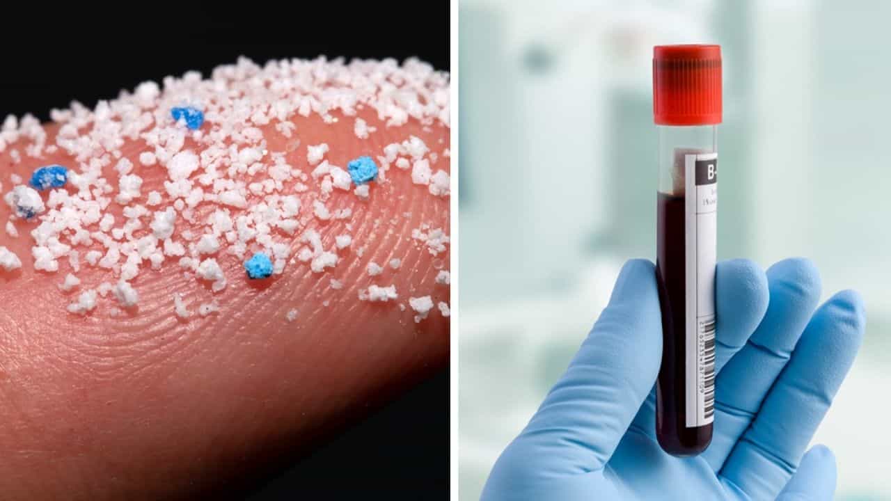 Human Blood: মানব রক্তে মিলল প্লাস্টিকের কণা! চাঞ্চল্যকর তথ্যে চিন্তার ভাঁজ বিজ্ঞানীদের কপালে Human Blood: মানব রক্তে মিলল প্লাস্টিকের কণা! চাঞ্চল্যকর তথ্যে চিন্তার ভাঁজ বিজ্ঞানীদের কপালে
