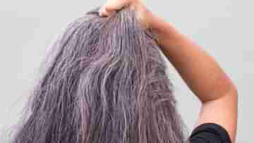 Premature Hair Greying: অকালে চুল পেকে যাওয়া থেকে মুক্তি পেতে মেনে চলুন এই ৬ ঘরোয়া উপায়