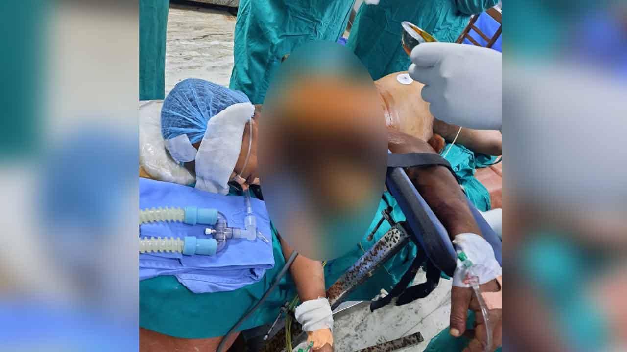 Uttarbanga Medical College: অটোর ধারে বসেছিলেন, বাঁশে মহিলার স্তন হয়ে যায় এফোঁড়-ওফোঁড়! তার পরের ঘটনা চমকে দেওয়ার মতো...