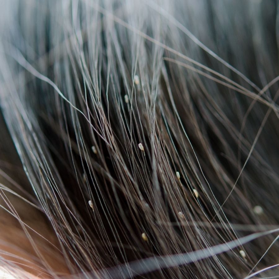 একই সঙ্গে উকুন তাড়ানোর শ্যাম্পুও পাওয়া যায় বাজারে। সেগুলোও নিয়মিত ব্যবহার করতে পারেন। পাশাপাশি চুলের চিরুনি, ব্রাশ বা চুলে ব্যবহৃত বিভিন্ন পণ্য কমপক্ষে ১০ মিনিটের জন্য গরম সাবান জলে ভিজিয়ে পরিষ্কার করুন।