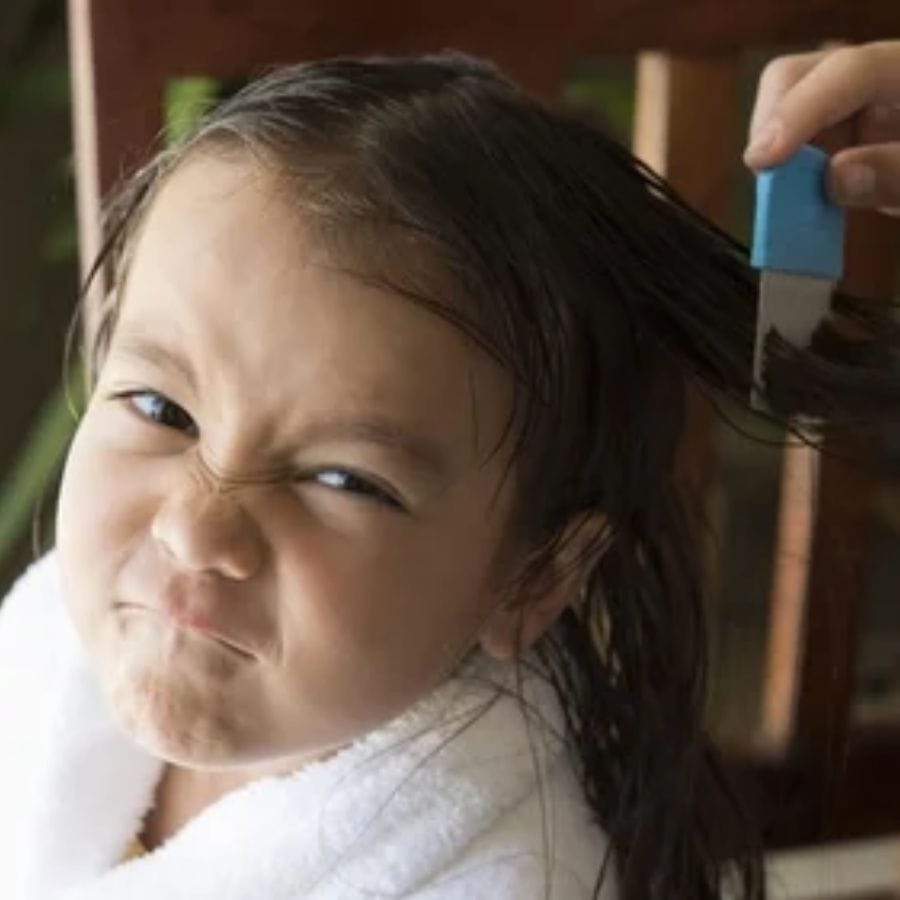 পেট্রোলিয়াম জেলি (ভ্যাসলিন) থেকে শুরু করে জলপাই তেল, মাখন বা মেয়োনিজ মাথার ত্বকে ব্যবহার করে সারারাত শাওয়ার ক্যাপ দিয়ে মাথা ঢেকে রাখুন। দেখবেন রাতারাতি উকুন মরে যাবে।