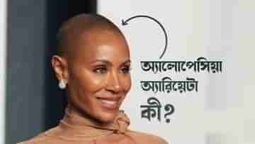 Alopecia Areata: অস্কারের সম্ভ্রান্ত মঞ্চ নতুন করে চেনাল টাকপোকার শারীরিক ও মানসিক কষ্ট