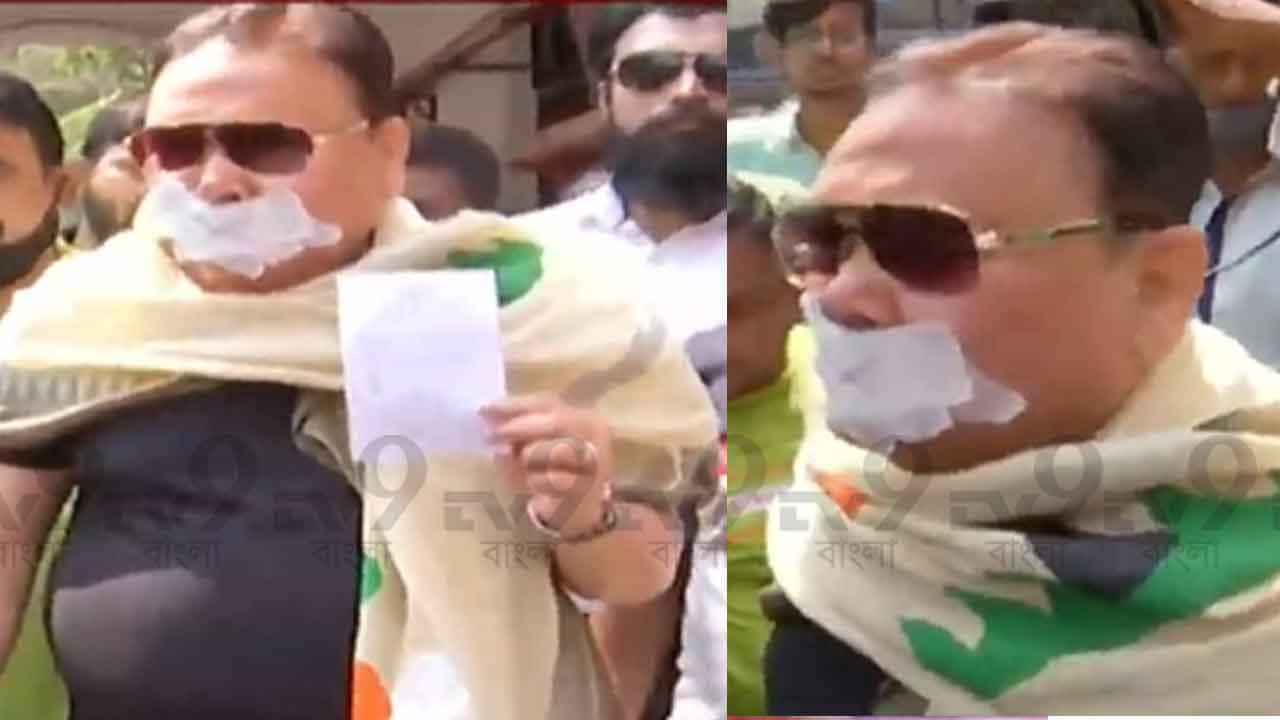 Madan Mitra: মুখে ব্যান্ডেজ, হাতে লেখা 'গলায় ব্যথা, পায়ে সর্ষে'... এসএসকেএম থেকে বেরোলেন এ কোন মদন মিত্র!