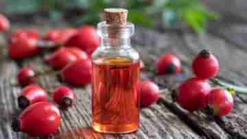 Rosehip Oil: ২০২২-এর নতুন বিউটি ট্রেন্ড রোজশিপ অয়েল! জানেন কি এর গুণাগুণ সম্পর্কে?