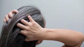 Hair Care Tips: প্রাকৃতিকভাবে চুল কালো করতে সরষের তেলের সঙ্গে এই ২টি জিনিস মেশালেই হবে কেল্লাফতে! Hair Care Tips: প্রাকৃতিকভাবে চুল কালো করতে সরষের তেলের সঙ্গে এই ২টি জিনিস মেশালেই হবে কেল্লাফতে!