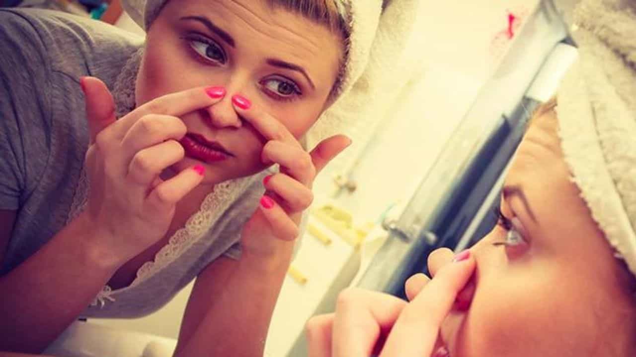 Blackheads: নাকের উপর জেদি ব্ল্যাকহেডস! ঘরোয়া উপায়ে এর থেকে মুক্তি পাবেন কীভাবে? Blackheads: নাকের উপর জেদি ব্ল্যাকহেডস! ঘরোয়া উপায়ে এর থেকে মুক্তি পাবেন কীভাবে?