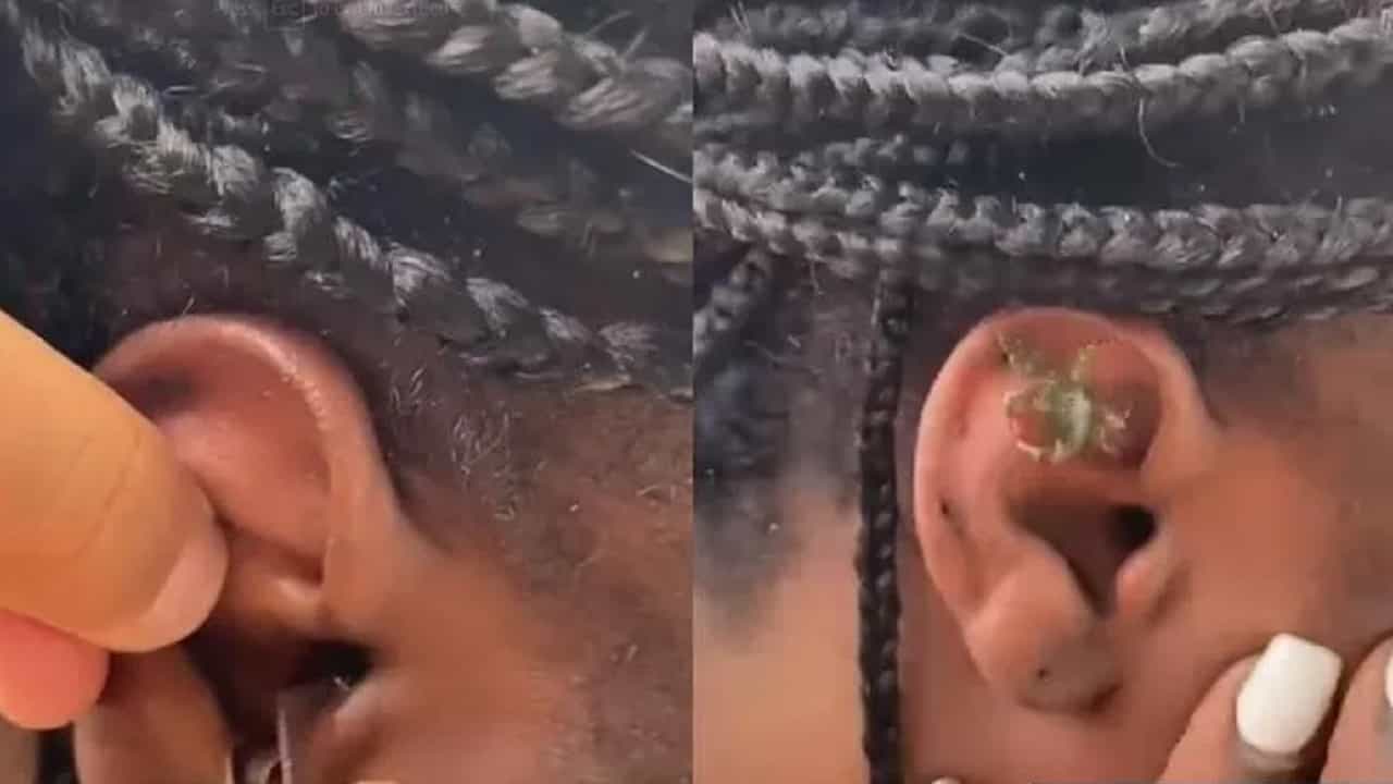 Viral Video: জ্যান্ত কাঁকড়া ঢুকে পড়ল মহিলার কানে, তারপর যা হল, তা দেখে নেটিজেনদের চোখ কপালে!