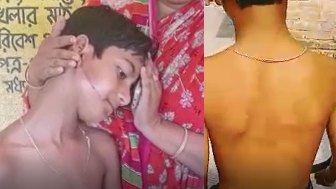 Deganga School Student Beaten: চিড়ে গিয়েছে মুখ, পিঠে কালশিটের দাগ, প্রধান শিক্ষকের মারে স্তম্ভিত অভিভাবকরা