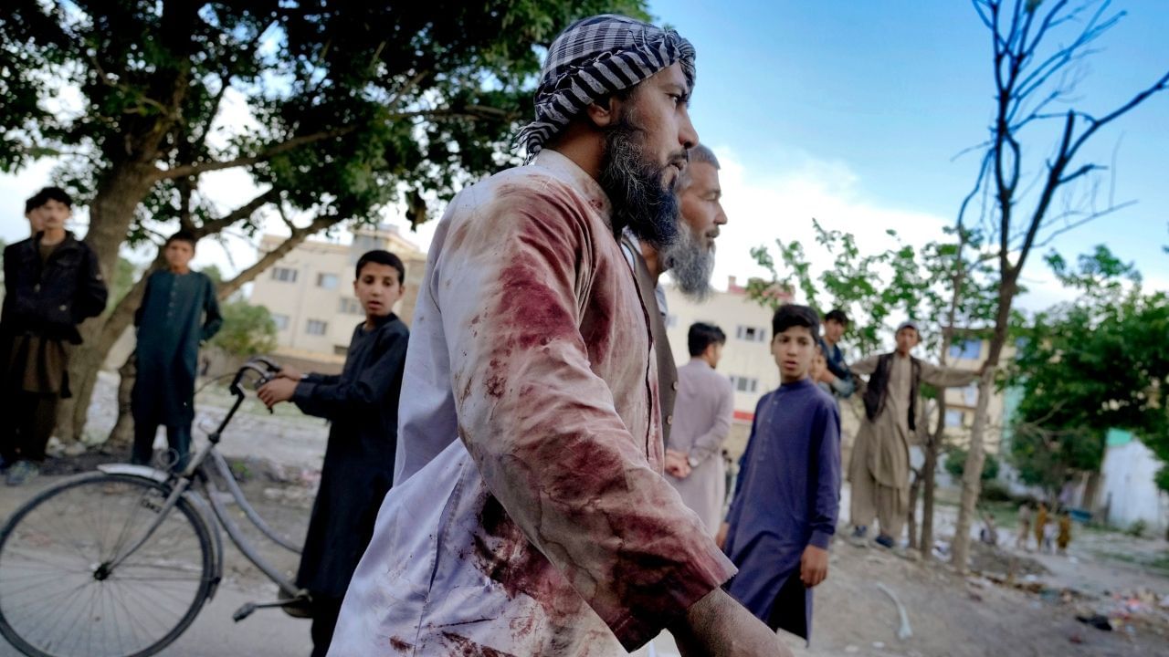 Kabul Mosque Blast: রেহাই মিলল না রমজানের শেষ শুক্রবারেও, কাবুলের মসজিদে ভয়াবহ বিস্ফোরণে মৃত ১০ Kabul Mosque Blast: রেহাই মিলল না রমজানের শেষ শুক্রবারেও, কাবুলের মসজিদে ভয়াবহ বিস্ফোরণে মৃত ১০