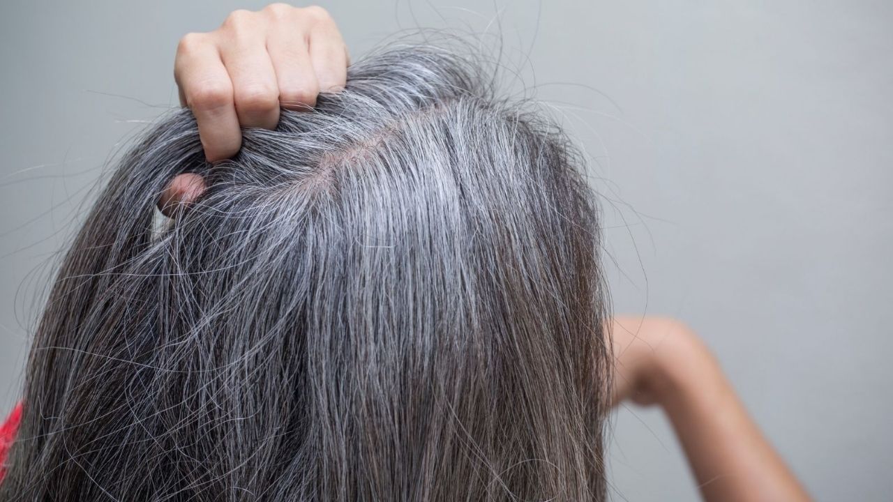 Greying of Hair: Prematurely ripening hair is playing twelve of beauty?  Follow the 5 ways of domestic and ayurvedic Try these home remedies to slow  down for premature greying of hair IG