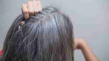 Greying of Hair: অকালে পেকে গিয়ে চুলের সৌন্দর্যের বারোটা বাজাচ্ছে? মেনে চলুন ঘরোয়া ও আয়ুর্বেদিক ৫ উপায়