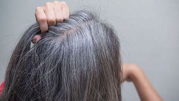 Greying of Hair: অকালে পেকে গিয়ে চুলের সৌন্দর্যের বারোটা বাজাচ্ছে? মেনে চলুন ঘরোয়া ও আয়ুর্বেদিক ৫ উপায়