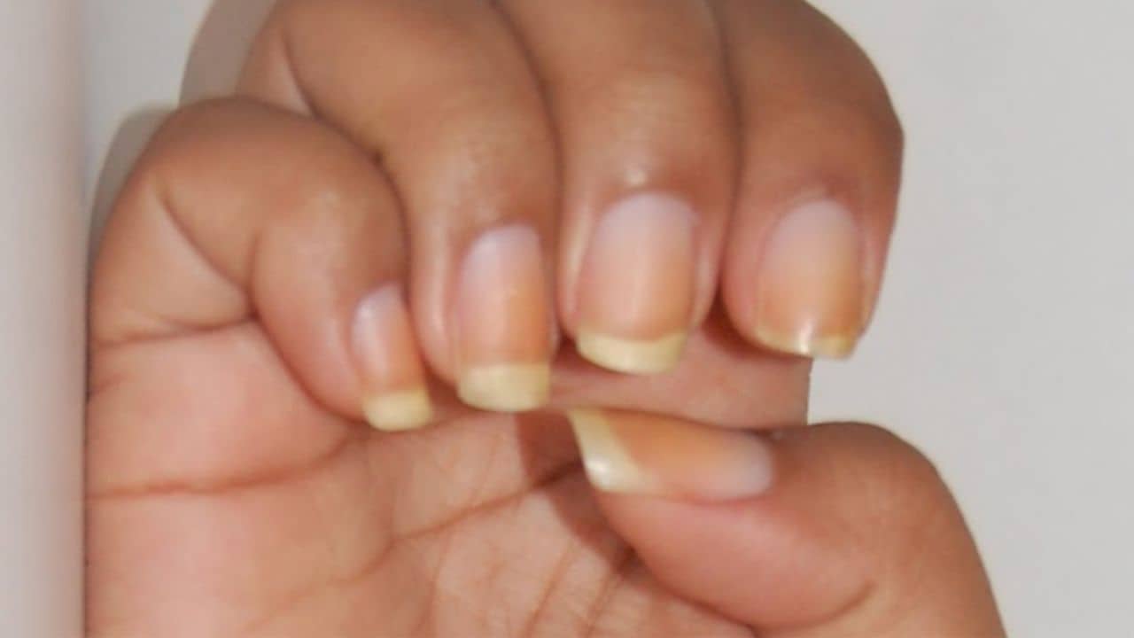 Nail Care Tips: নখের একগুঁয়ে হলদেটে ভাব দূর করবেন কীভাবে? রইল ৪টি খুব সহজ ঘরোয়া প্যাক