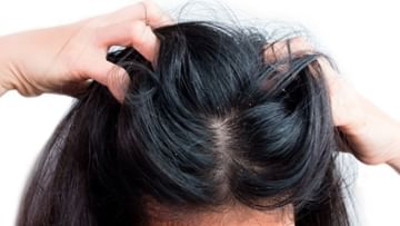 Hair Care Tips: নারকেল তেল ও জবা ফুলেই সারবে খুশকির সমস্যা! এই ভেষজ হেয়ার অয়েলে পাবেন সুফল