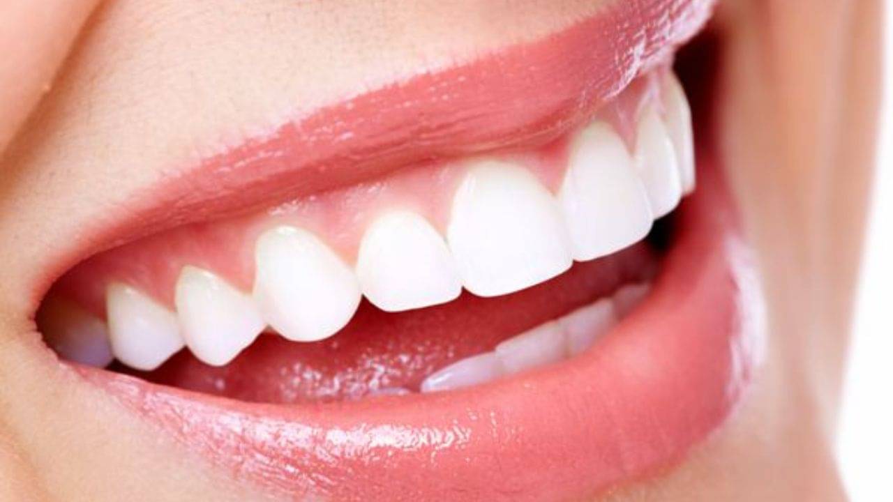 Whiten Teeth: সাদা দাঁতে চোখে লাগবে ধাঁধা! রইল ঝকঝকে দাঁত পাওয়ার দারুণ কার্যকরী ভেষজের খোঁজ