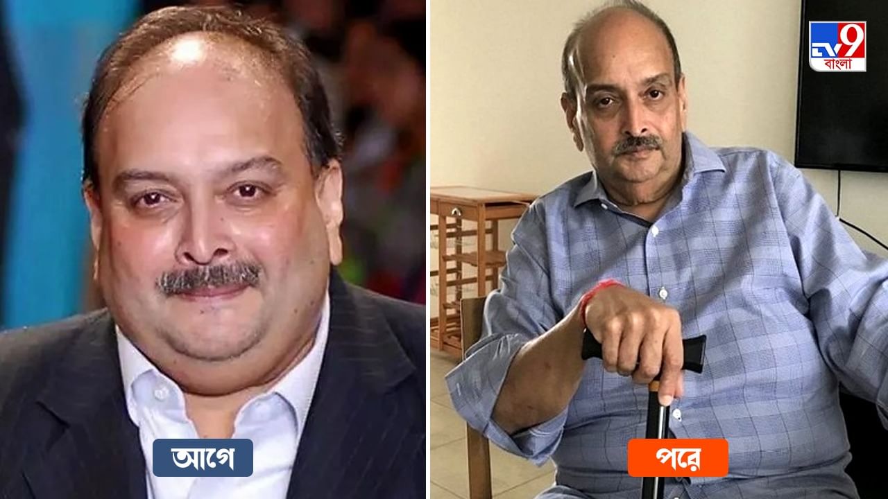 Mehul Choksi: আপাতত স্বস্তি! মেহুল চোকসির বিরুদ্ধে 'অবৈধ অনুপ্রবেশ'-র মামলা প্রত্যাহার ডমিনিকার