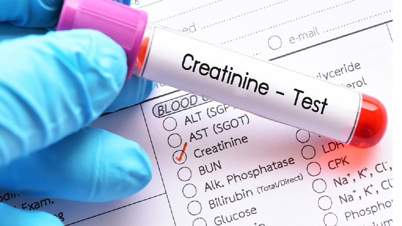 Creatinine Levels: ডায়াবেটিসে ভুগছেন? ক্রিয়েটিনিন নিয়ন্ত্রণে রাখতে জরুরি এই টিপসগুলি...
