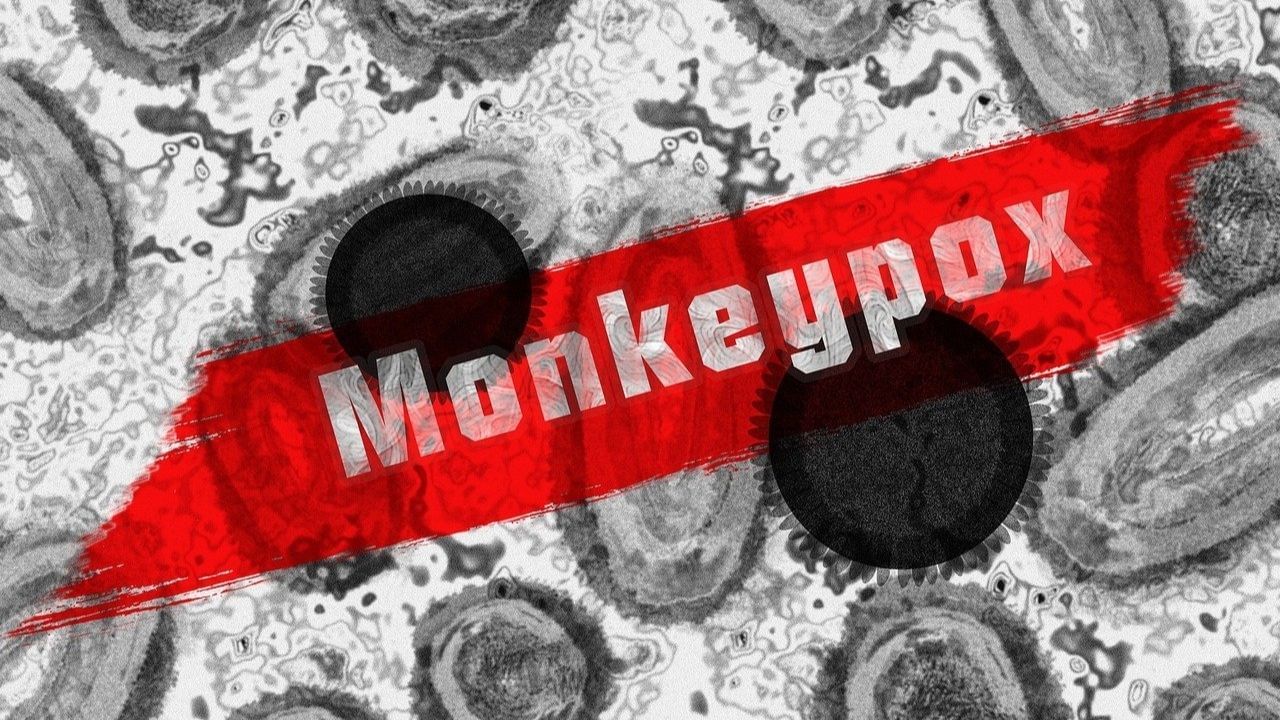 WHO on Monkeypox: 'এটা হিমশৈলের চূড়ামাত্র', মাঙ্কিপক্স নিয়ে কোন ভয়ের বার্তা দিল বিশ্ব স্বাস্থ্য সংস্থা? WHO on Monkeypox: 'এটা হিমশৈলের চূড়ামাত্র', মাঙ্কিপক্স নিয়ে কোন ভয়ের বার্তা দিল বিশ্ব স্বাস্থ্য সংস্থা?