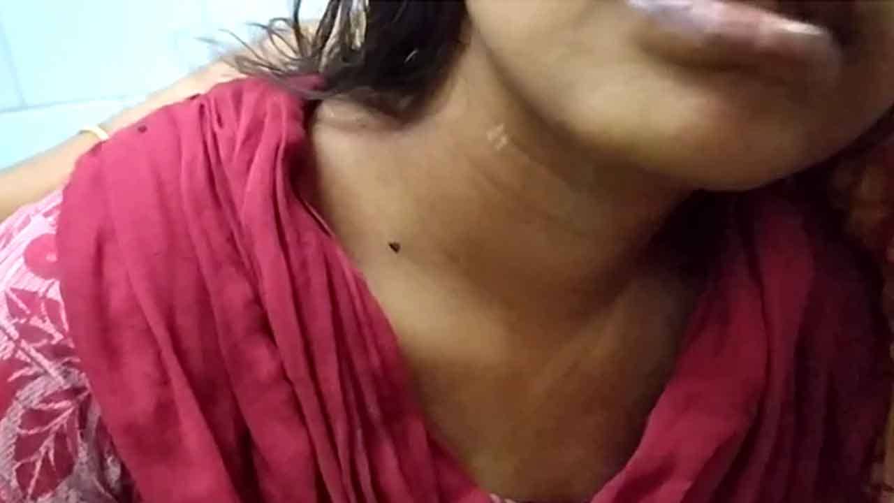 Basirhat Domestic Violence: সারা শরীরে ছ্যাঁকা, বউকে জলে ডুবিয়ে খুনের চেষ্টার অভিযোগ