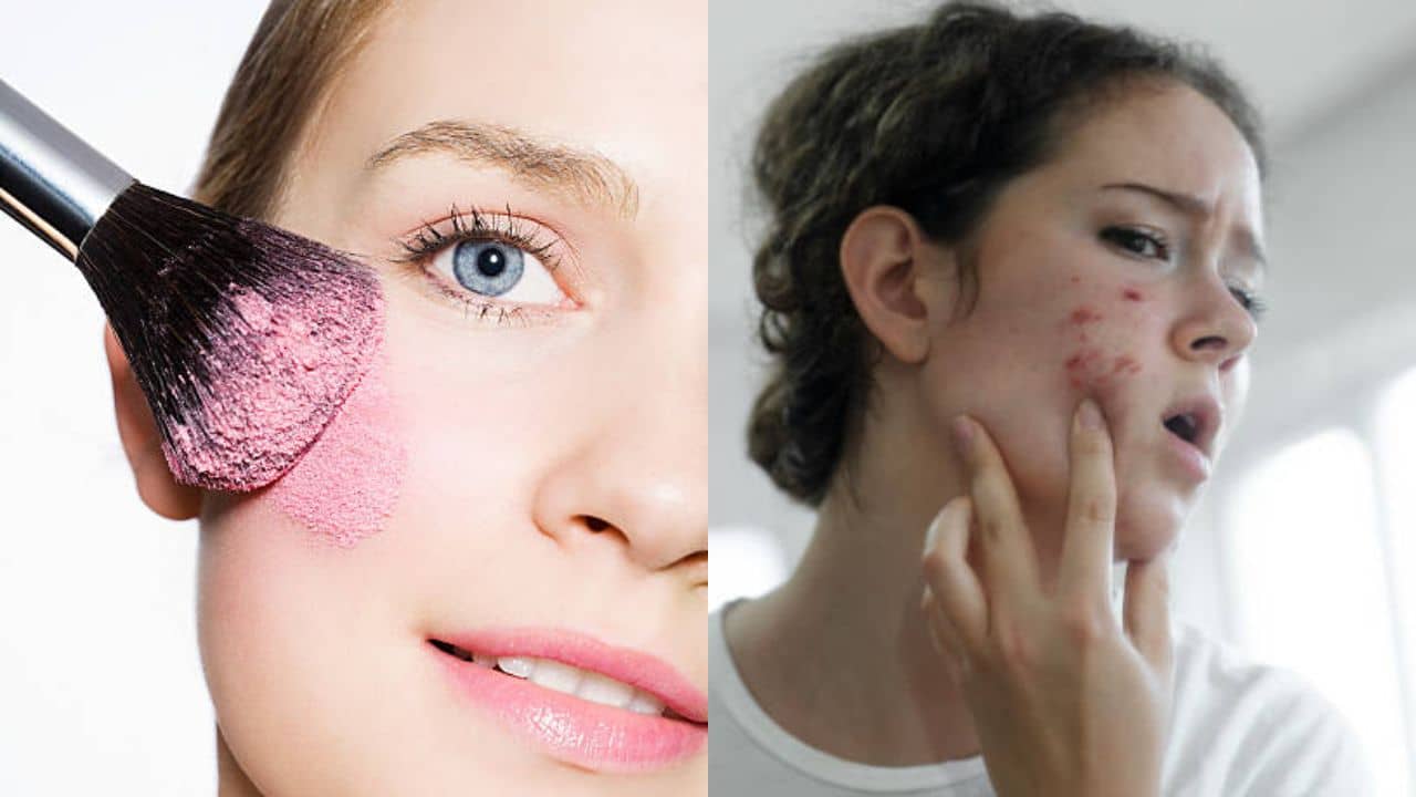 Skin Care Tips: ক্রিম-বেসড ব্লাশ কি ব্রণর জন্য দায়ী? জানুন কোথায় ভুল করছেন
