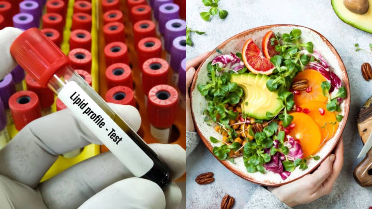 Triglycerides: লিপিড টেস্টে ট্রাইগ্লিসারাইড ধরা পড়েছে? ওষুধ নয়, খাদ্যাভ্যাসে ভরসা রাখুন