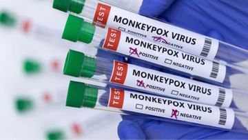 Monkeypox: হু হু করে বাড়ছে মাঙ্কিপক্স ভাইরাস! ৩০ দেশে আক্রান্তের সংখ্যা একলাফে ৫৫০