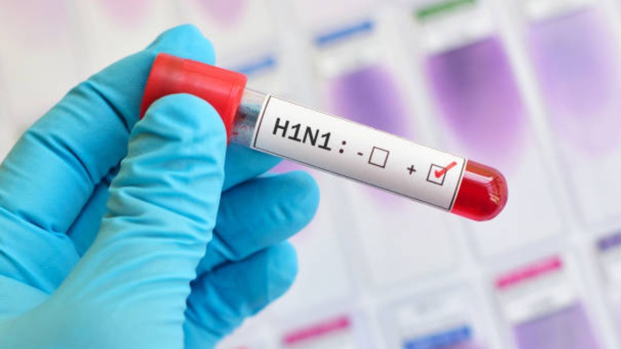 Swine Flu: ভাইরাস নিয়ে আতঙ্ক যেন পিছু ছাড়ছে না! করোনা ও মাঙ্কিপক্সের পর এবার পালা সোয়াইন ফ্লুর
