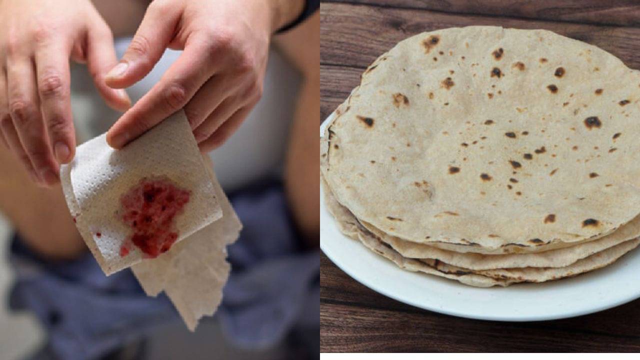 Piles Diet Plan: অর্শের জ্বালায় কষ্ট পাচ্ছেন? রোজের এই ৫ খাবার পাতে আছে তো!