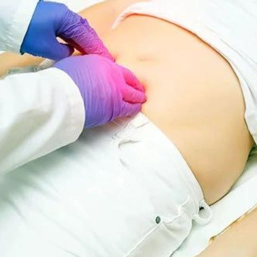 বয়স, গর্ভাবস্থা, গুরুতর আঘাতের কারণে পেটের ক্ষতি, পারিবারিক ইতিহাস, কোষ্ঠকাঠিন্য, ভারী ওজন তুললে, হঠাৎ ওজন বৃদ্ধি পেলে হার্নিয়া দেখা যায়। বিশেষ করে ছেলেদের ডানদিকের কুঁচকিতে গ্রয়েন হার্নিয়া হয়৷ আসলে জন্মগত কারণে ছেলেদের কুঁচকির জায়গায় একটি ছিদ্র থাকে। ভ্রূণ অবস্থায় অণ্ডকোষ ছেলেদের পেটের ভিতর তৈরি হয়।