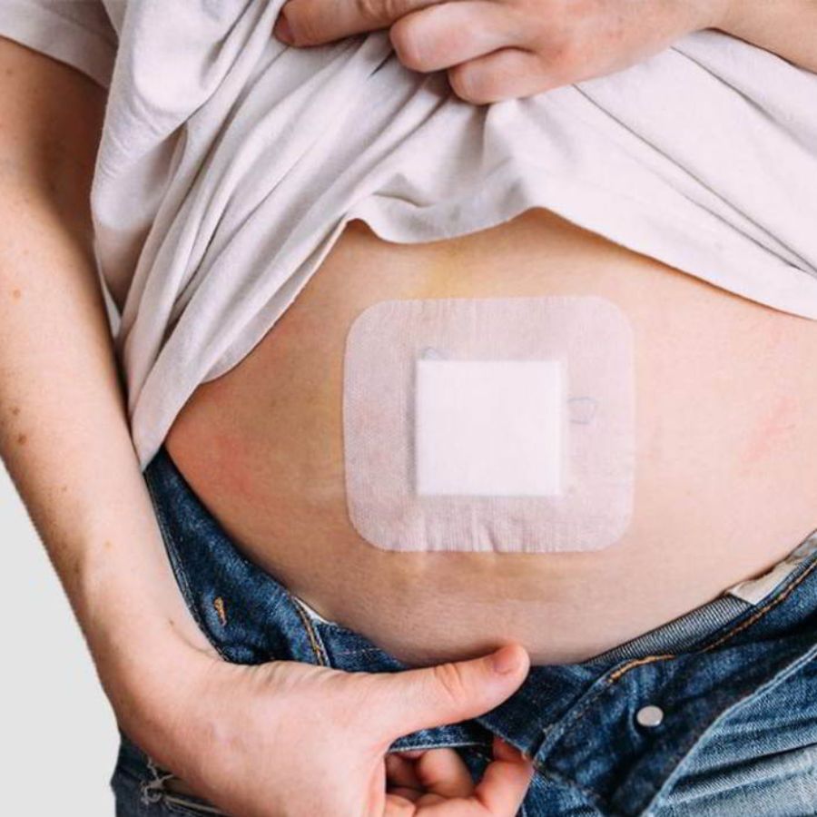 হার্নিয়া ধরা পড়লে প্রথমেই ডাক্তারের সঙ্গে পরামর্শ নিন। হার্নিয়ার একমাত্র সমাধান অপারেশন। অপারেশনের প্রকারভেদ রয়েছে কিন্তু অপারেশন ছাড়া হার্নিয়ার চিকিৎসার আর কোনও বিকল্প নেই।